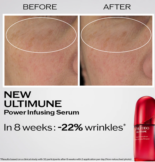 Shiseido Ultimune Power Infusing Serum serum przeciw starzeniu się skóry